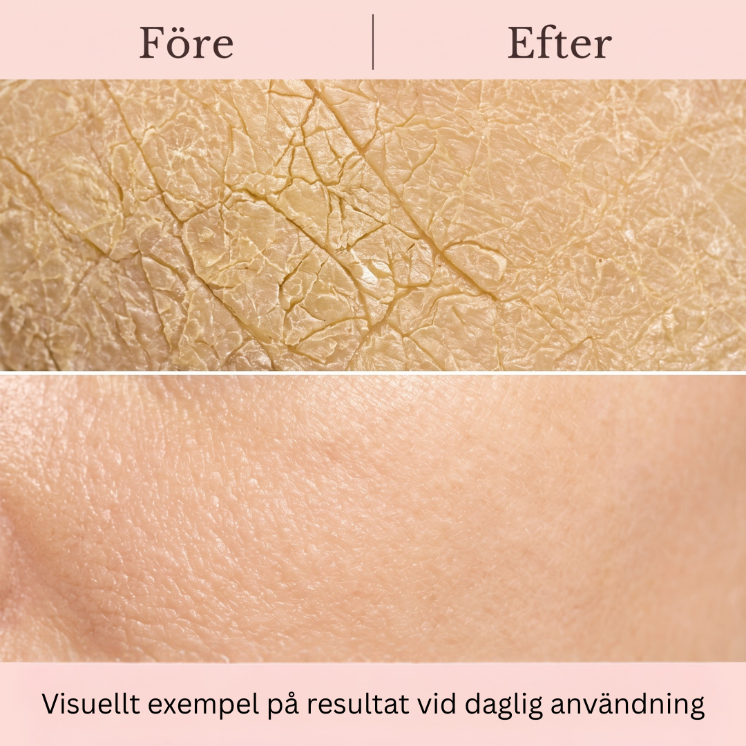 PureDerm Retinol Body Treatment