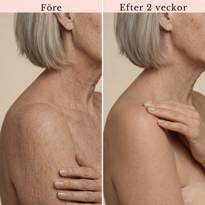 PureDerm Retinol Body Lotion